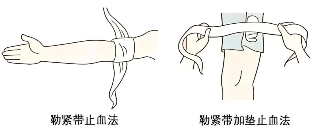 意外发生第一时间应这样自救