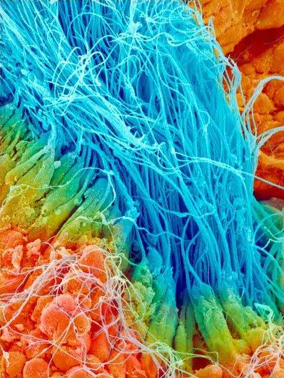 电子显微镜下的人体组织,很美的,你看过几个