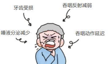 老年人的吞咽障碍要小心!