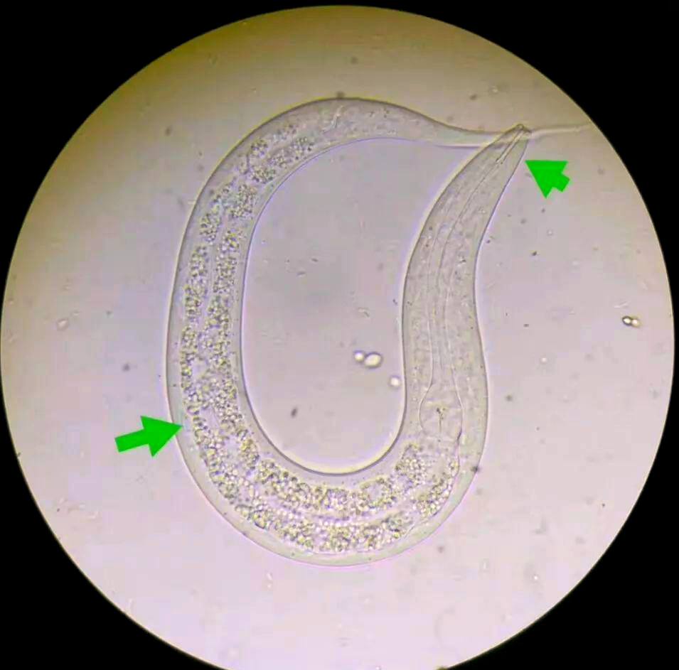 粪类圆线虫与钩虫幼虫的鉴别全攻略