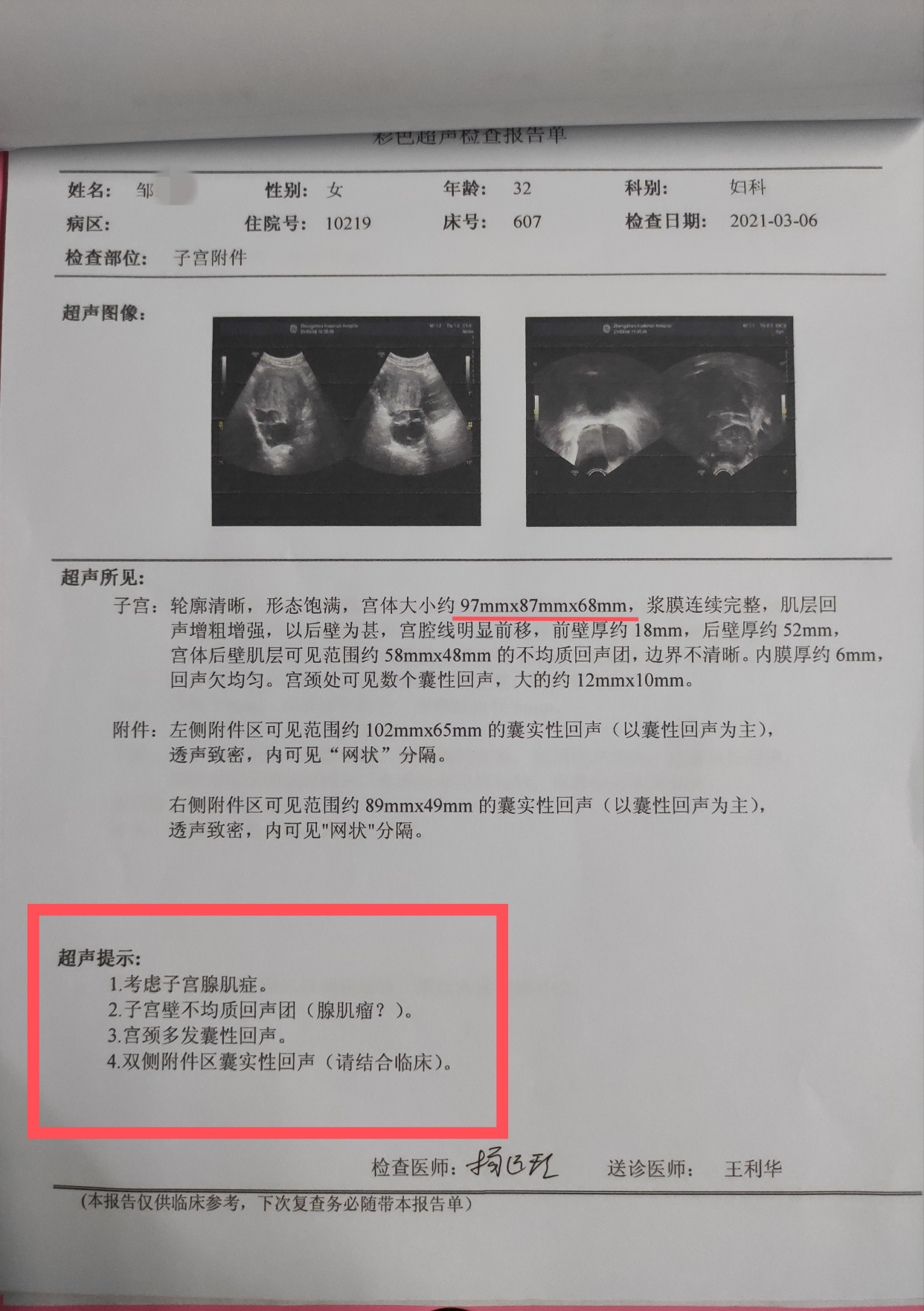 【山东菏泽】止疼片,曼月乐环,中药都无法缓解疼痛.