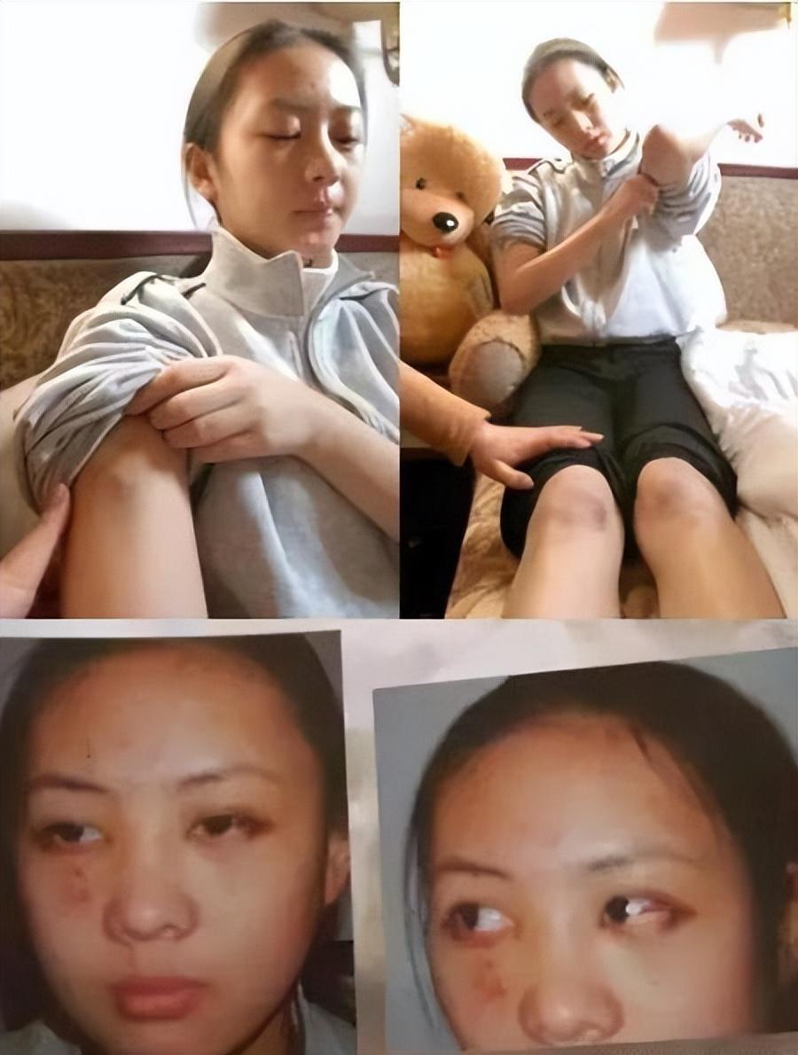 37岁童瑶疑似怀孕,肚子凸起身材发福孕味足,宝宝座椅抢镜!