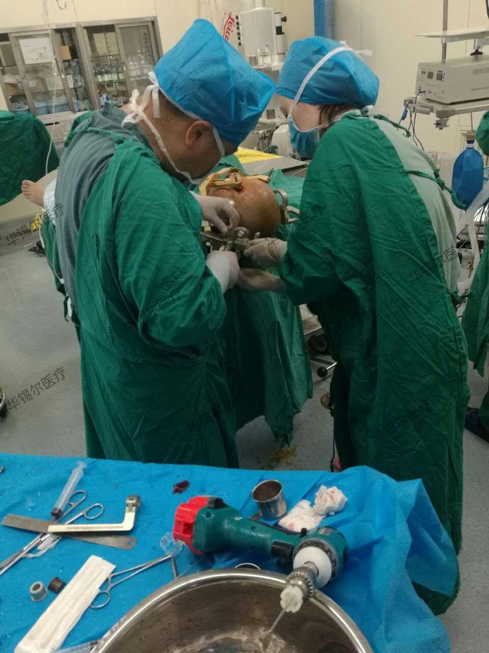 脑立体定向系统——立体定向手术头架