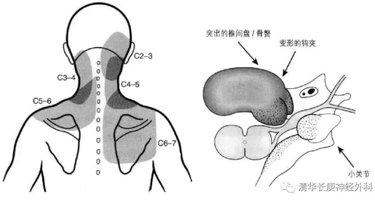 长颈鹿的脖子竟然和人类一样只有七节?