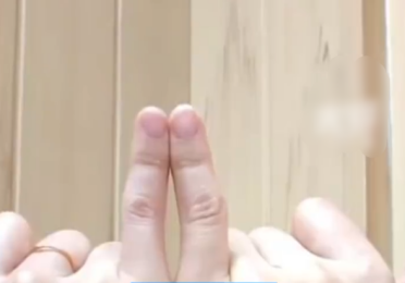 女子长期用小拇指托手机后果：日均刷机8小时手指变形