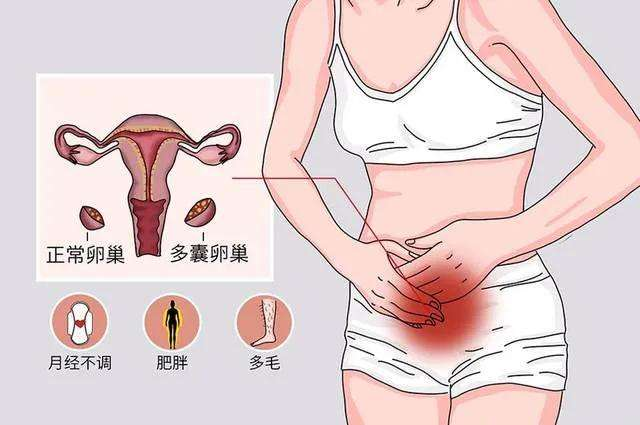 哪些女性易患子宫内膜异位症