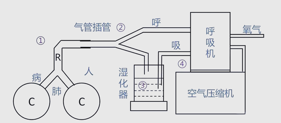 呼吸机基本原理与病人呼吸的关系揭秘