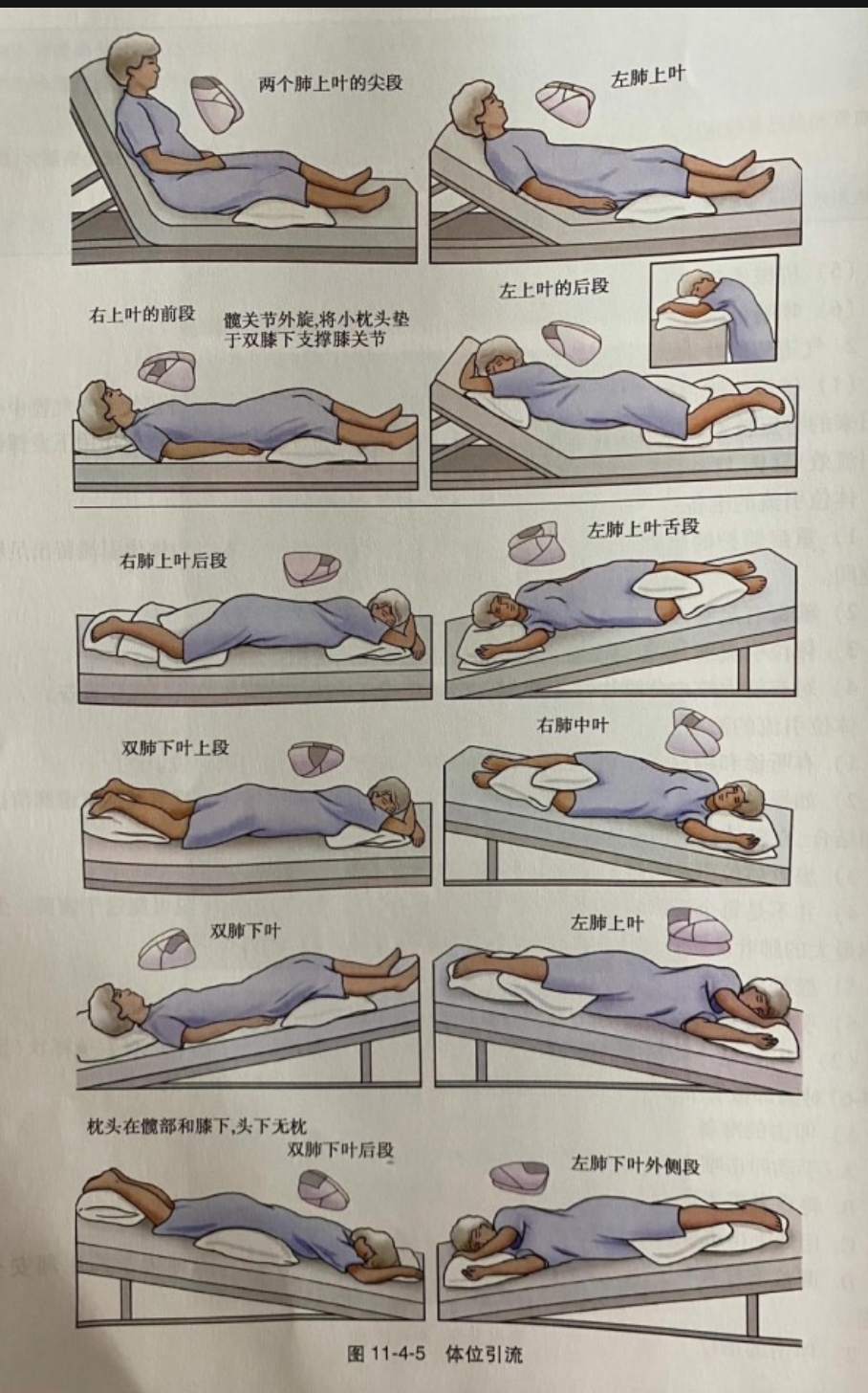 卧床病人排痰手法图图片