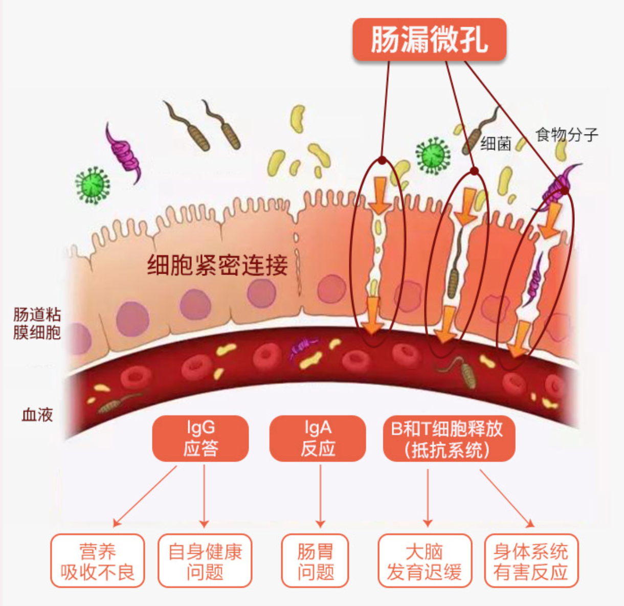 漏肠症状图片