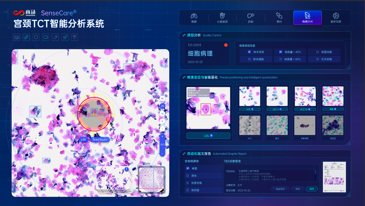 ai助病理診斷大幅提速,瑞金醫院發佈《數字化智慧病理科建設白皮書》