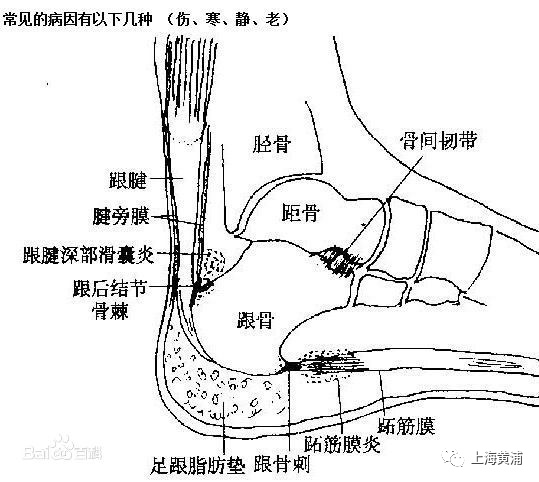 右跟骨前缘的位置图图片