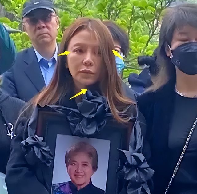 丧母后朱迅近况惹人忧!脸僵凹陷笑起来费力,眉毛稀疏撞脸蔡明