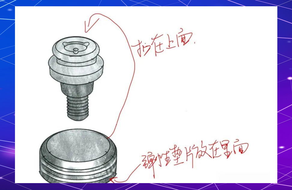种植覆盖义齿中的locator基台与杆卡附着体解析