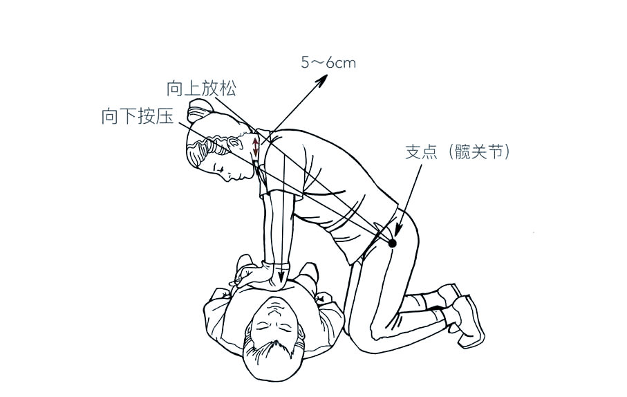 成人心肺复苏操作指南与注意事项