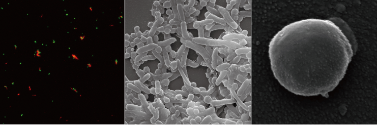又一新型产甲烷古菌被发现 再次登上《自然》杂志