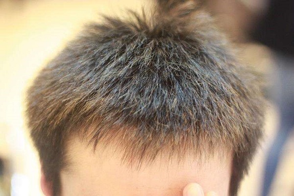 两边头发翘起来怎么办