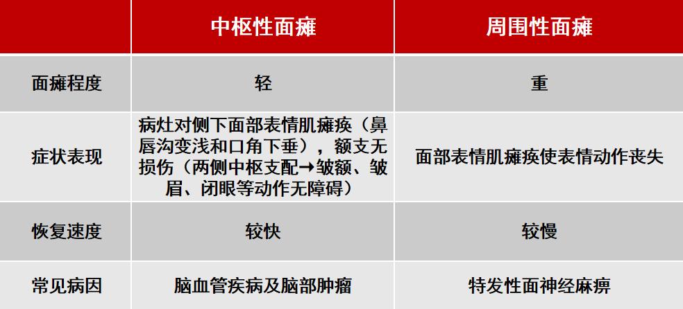 中枢性面瘫与周围性面瘫如何鉴别?这5点要知道