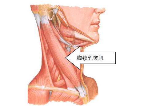 先天性肌性斜颈如何治疗?