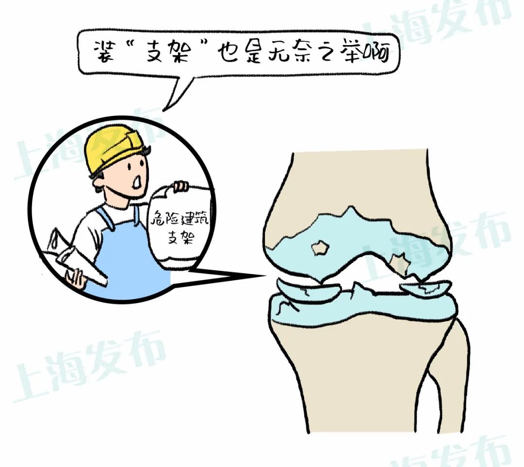「医聊」膝盖疼是因为软骨坏了,怎样让腿上的"铰链"复原?