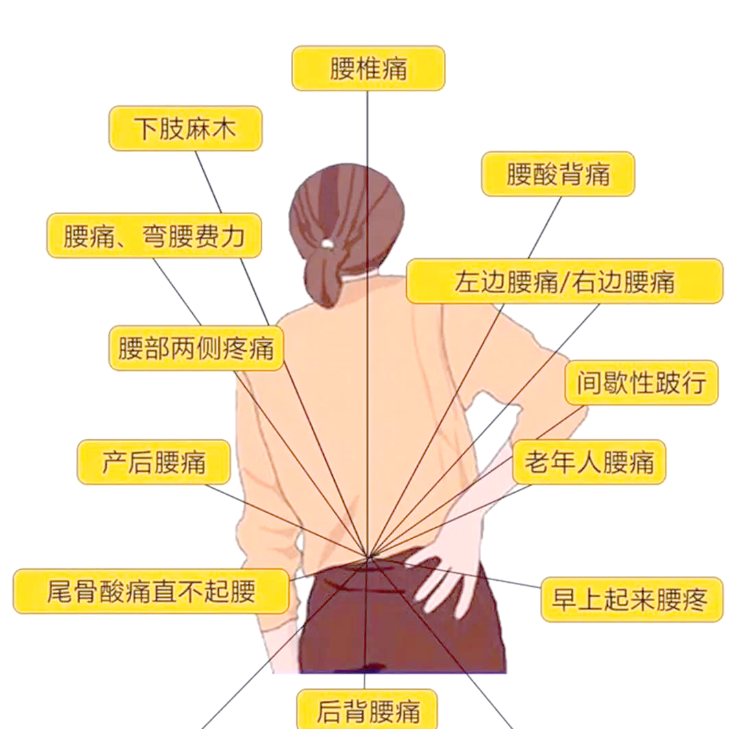 女性腰疼位置与健康问题解析:全面了解疼痛,关爱自身健康