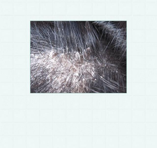 若管不住手下场会怎样?