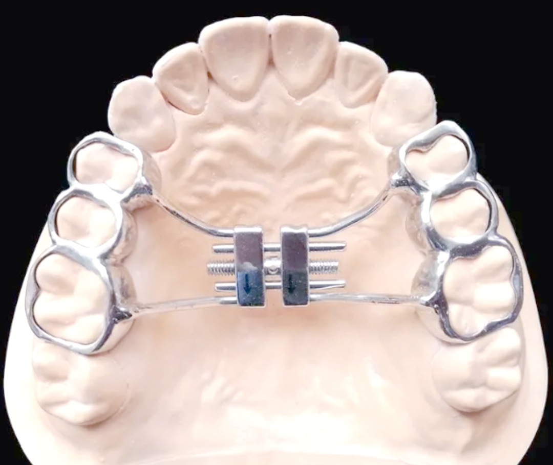 正畸矫治器在临床中的多样化应用