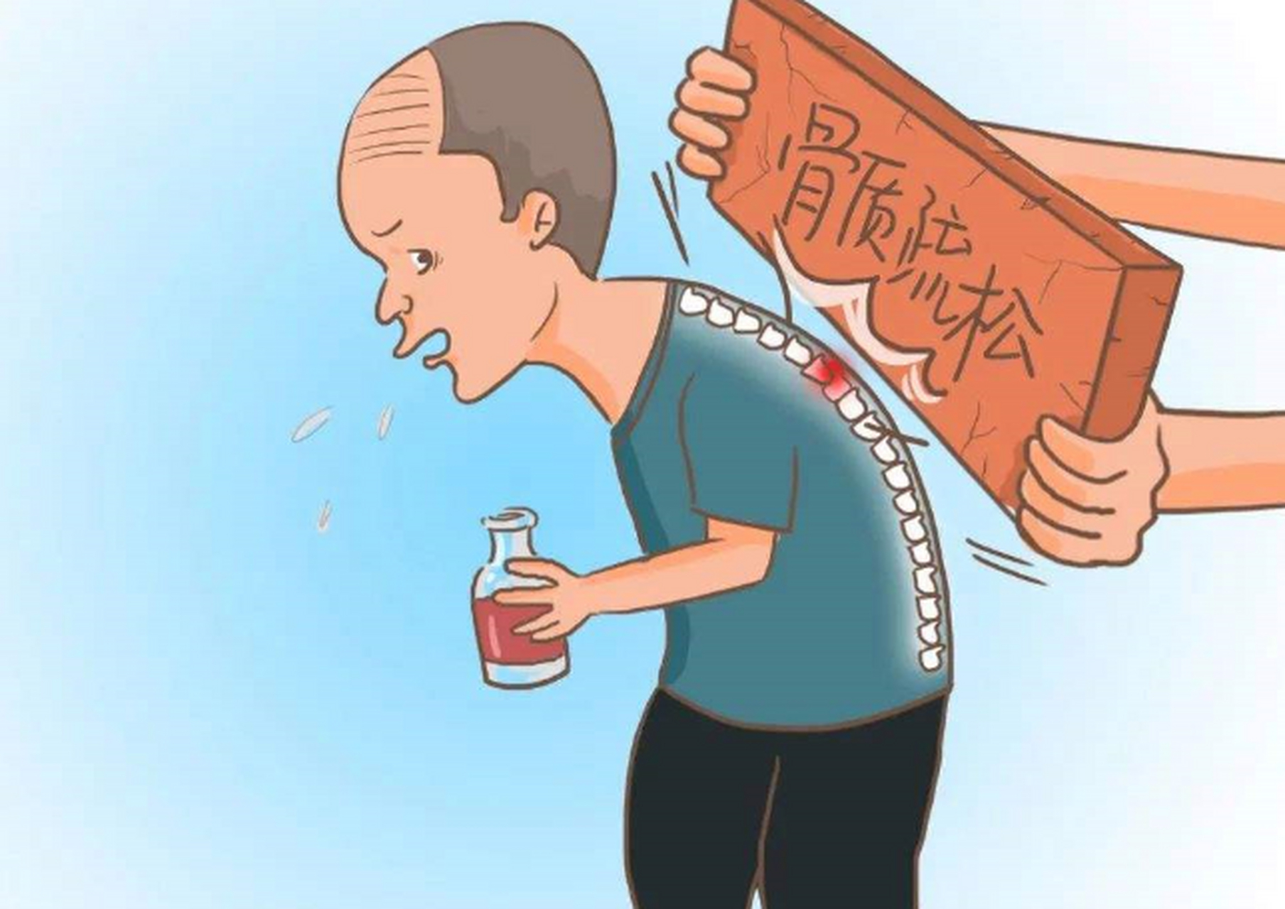 骨质疏松症是一种常见的老年疾病,可引起骨折,脊椎侧弯,关节破坏等多