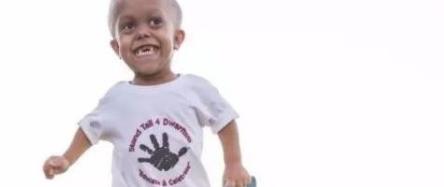 "诺必行婴宝"侏儒症遗传吗?侏儒症在婴幼儿期有何表现?