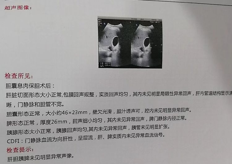 胆囊息肉需要切除胆囊吗?深圳华侨医院开展微创保胆手术