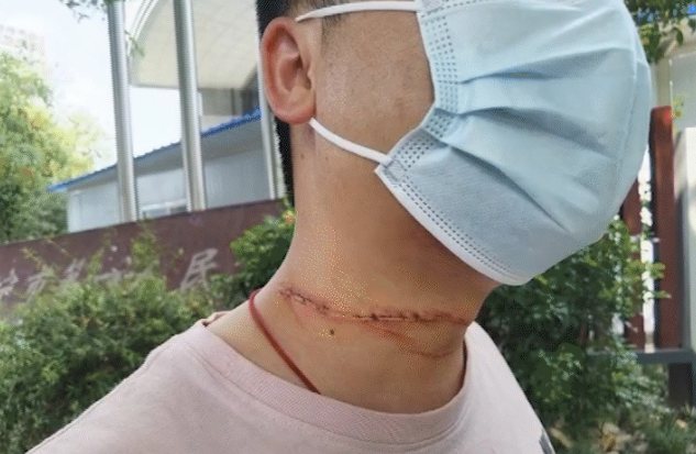 男子公园骑摩托车撞上风筝线 提醒:风筝线伤人时有发生