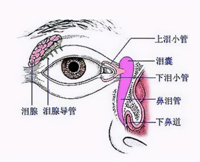 宝宝眼泪汪汪 泪道阻塞惹祸