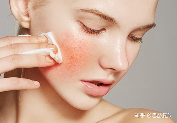 为什么不要轻易使用功效性化妆品,会有什么危害