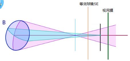 散光,这一篇科普给你讲透