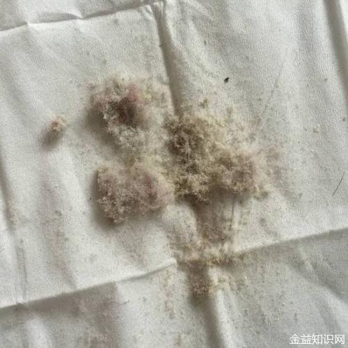 怎么判断床上有螨虫