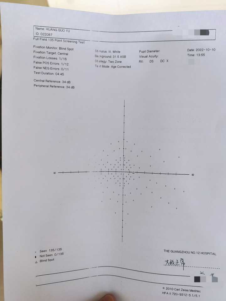 单眼水平视野150度是怎么检测的?