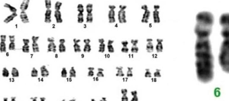 猫叫综合征:从症状到治疗的全面解析与专家团队介绍