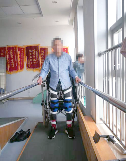 矫形器定制：健康未来的新篇章
