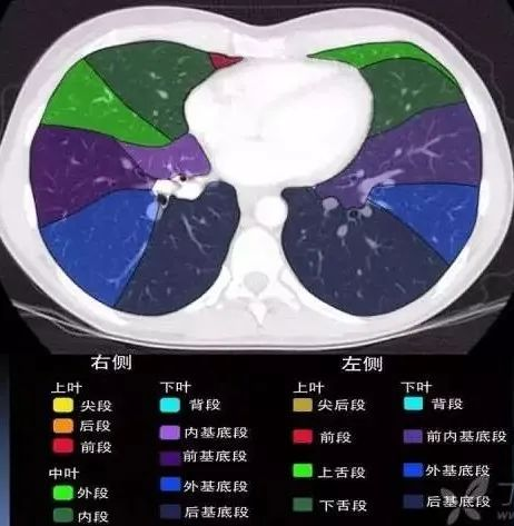肺叶分段ct图像详解