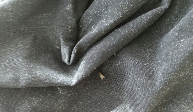 卫衣掉毛毛沾了一身怎么办