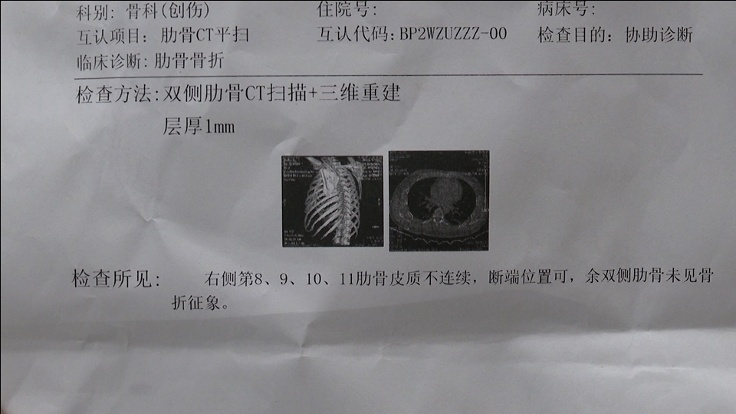 摔断四根肋骨!那一刻,他得多疼啊