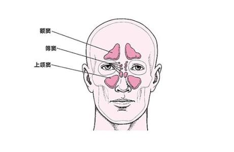 正常上颌窦图片图片