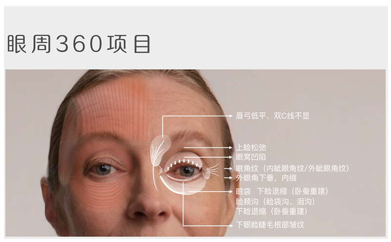 针美汇眼部专利眶骨韧带剥离术