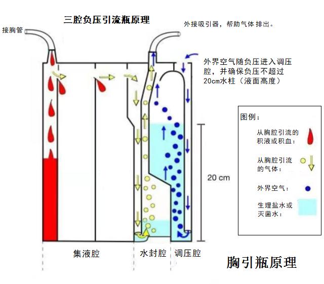 三腔闭式引流瓶原理图图片