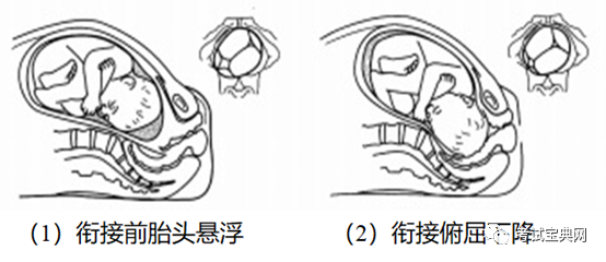 正常分娩-枕先露的分娩机制