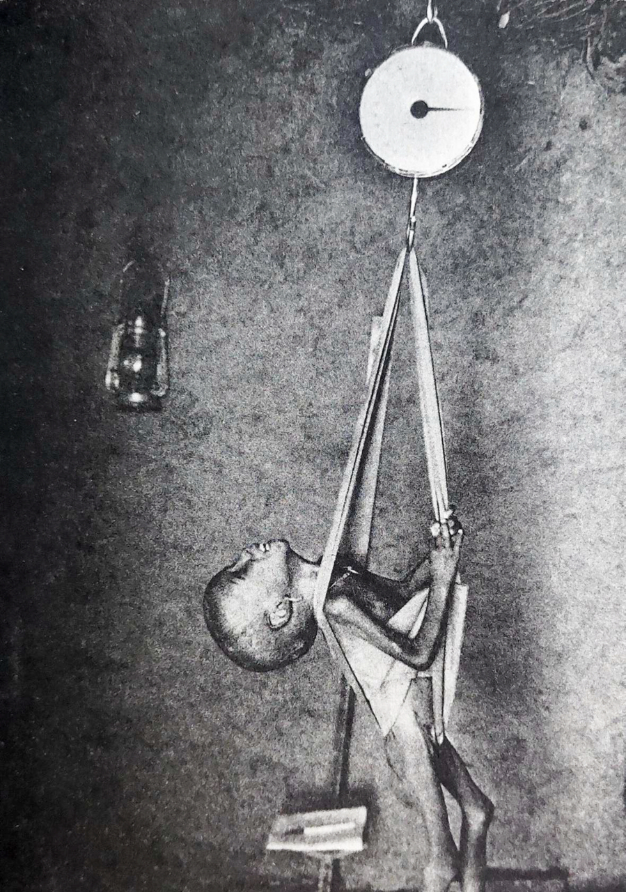 1985年的马里,一张照片上有一个骨瘦如柴的孩子和一个体重称!