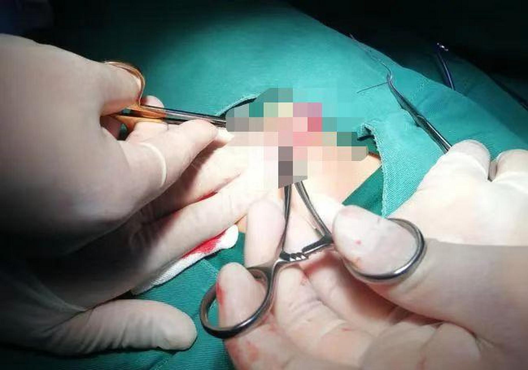 "没有阴茎,没有睾丸,医生,你确定没看错吗?