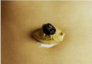 艾炷隔盐灸法治腹泻,简便易行,患者不妨一试!