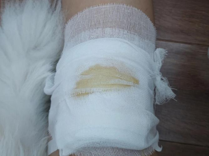 掌握急救包扎与止血技巧:详细指南