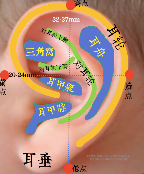 正常耳廓耳輪弧度自然豐滿,對耳輪上,下腳及舟狀窩清晰,顱耳角30