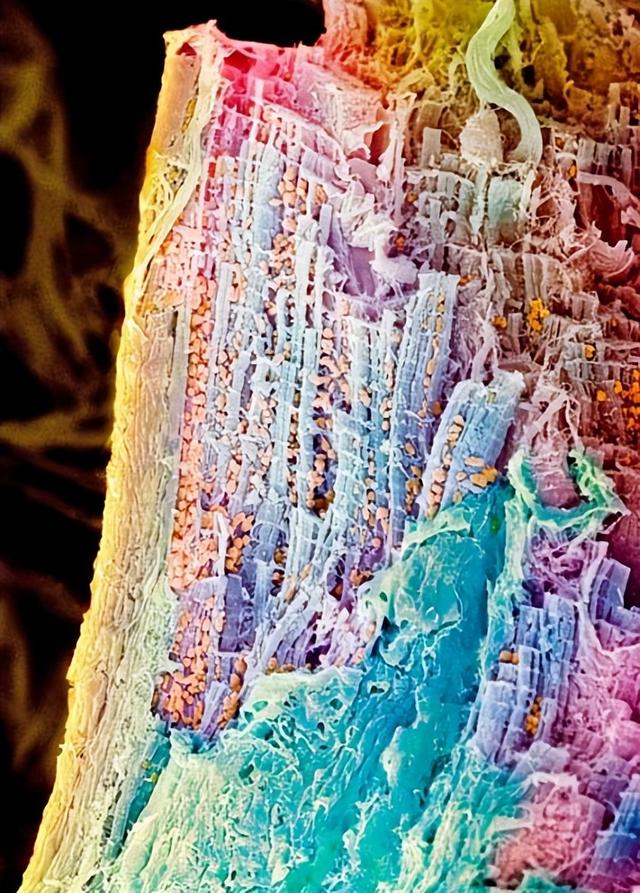 电子显微镜下的人体组织,很美的,你看过几个